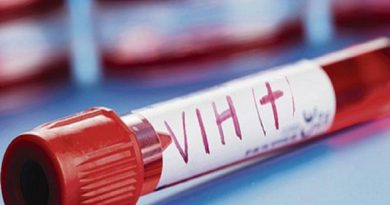 Virus de Inmunodeficiencia Adquirida (VIH), sida (Foto archivo agencias)
