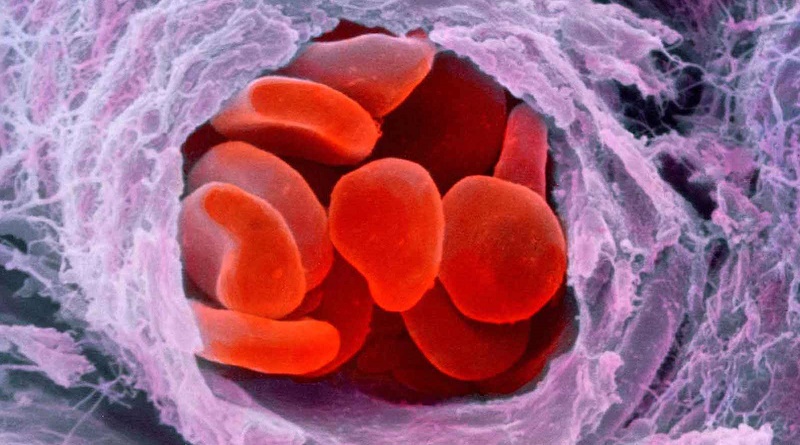 Diseñan sistema que utiliza chorro de plasma para eliminar infecciones