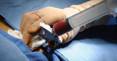 Gobierno Nacional garantiza viaje a Cuba de niños que requieren trasplante de médula ósea