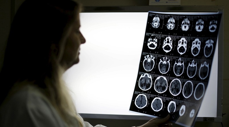 Científicos descubren dos 'recetas' para frenar envejecimiento de cerebro