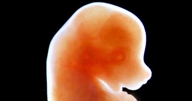 Un embrión de ratón de 13 días de edad (National Institutes of Health (NIH) / Wikimedia Commons)
