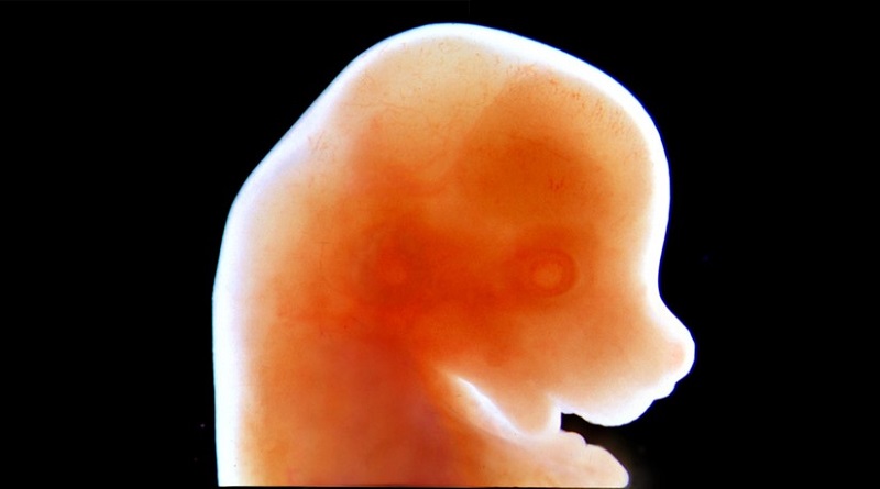 Un embrión de ratón de 13 días de edad (National Institutes of Health (NIH) / Wikimedia Commons)
