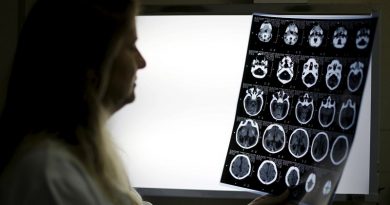 Científicos descubren dos recetas para frenar envejecimiento del cerebro