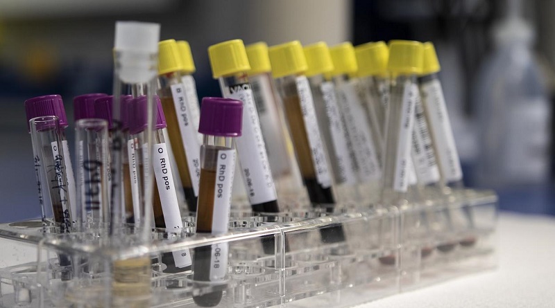Análisis de sangre detectaría alzhéimer hasta 20 años antes de su aparición