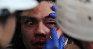 Chile se eleva a 360 Víctimas de trauma ocular en protestas