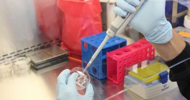 Científicos descubren en Brasil un virus "misterioso" sin genes reconocibles