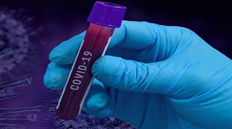 Rusia descubre nuevo método para curar pacientes con Covid-19