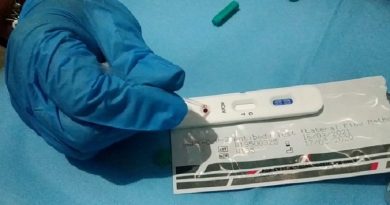 Inass ha aplicado pruebas de despistaje de Covid-19 a 1.375 personas en Centros Residenciales