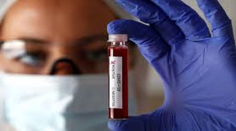 Más de 340 mil personas recuperados por coronavirus a escala global