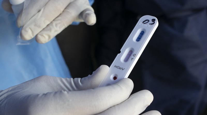 Activarán en Mérida un laboratorio de microbiología para realizar pruebas PCR
