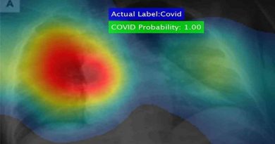 Tecnología australiana de imagen pulmonar progresa para el diagnóstico de la Covid-19