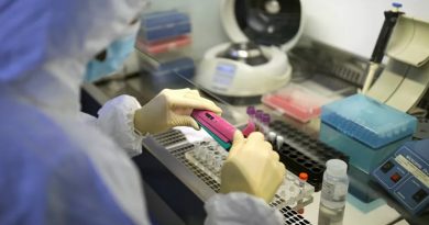 Anuncian que Rusia puede iniciar producción de vacuna contra Covid-19 en otoño 2020