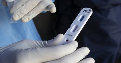 Plan Sucre ha realizado más de 22 mil pruebas rápidas de Covid-19 en la entidad