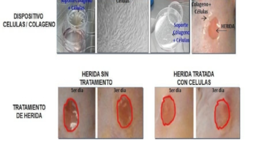 Expertos en medicina regenerativa desarrollan dispositivo de bioingeniería para curación de heridas