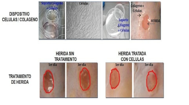 Expertos en medicina regenerativa desarrollan dispositivo de bioingeniería para curación de heridas