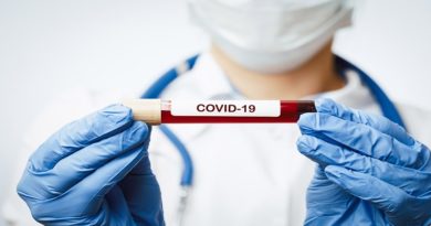 Uso de plasma en pacientes con COVID-19 es una alternativa fundamentada y segura que ha garantizado resultados positivos en Venezuela