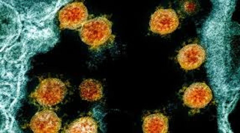 Expertos chinos desarrollan modelo de Inteligencia Artifical para diferenciar la COVID-19 de otras patologías médicas