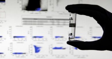 Investigadores desarrollan un test capaz de detectar anticuerpos contra la COVID-19