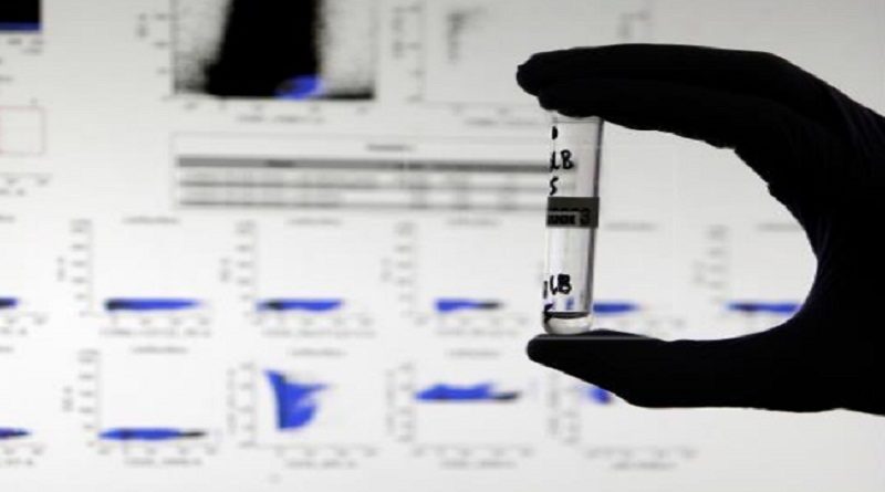 Investigadores desarrollan un test capaz de detectar anticuerpos contra la COVID-19