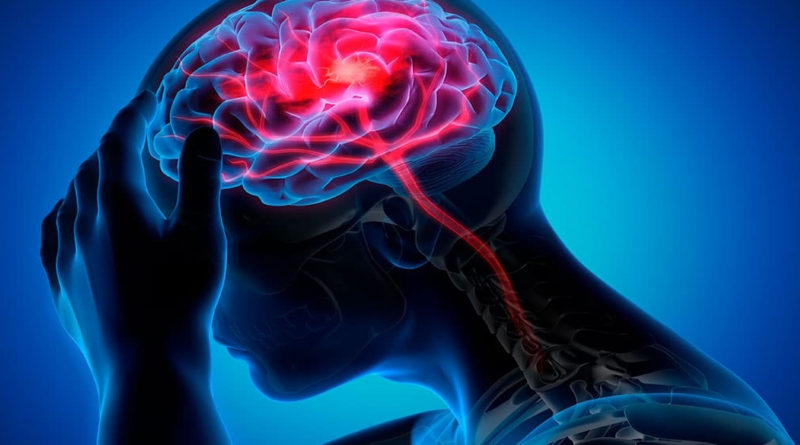 Conoce trucos para aliviar el dolor de cabeza sin fármacos
