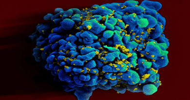 Descubren una proteína que bloquea la multiplicación del VIH