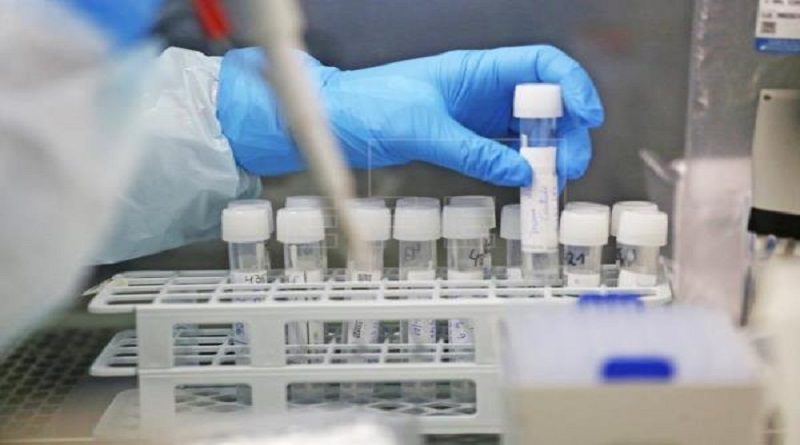 Científicos descubren método para bloquear infección de coronavirus