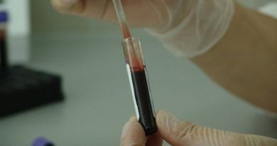 Tratamiento experimental contra el mieloma múltiple demuestra eficacia