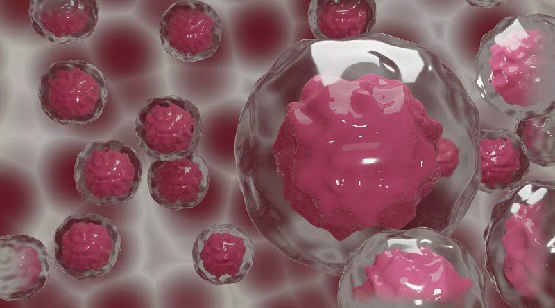 Científicos desarrollan método con cristales para diagnosticar con precisión el cáncer