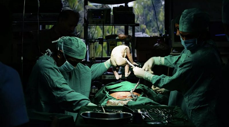 Los bebés prematuros a menudo sufren de enfermedades como la parálisis cerebral, el retraso cognitivo o la sordera, entre otras
