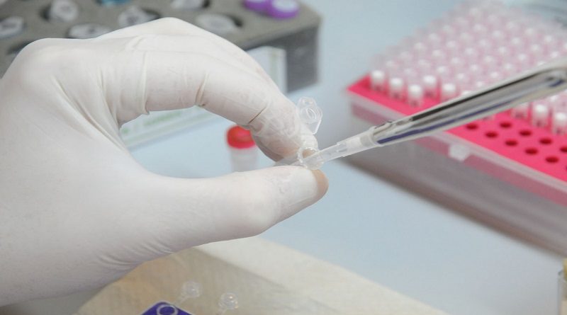Venezuela y República Checa comparten investigación para evaluar inmunidad celular contra el SARS-CoV-2