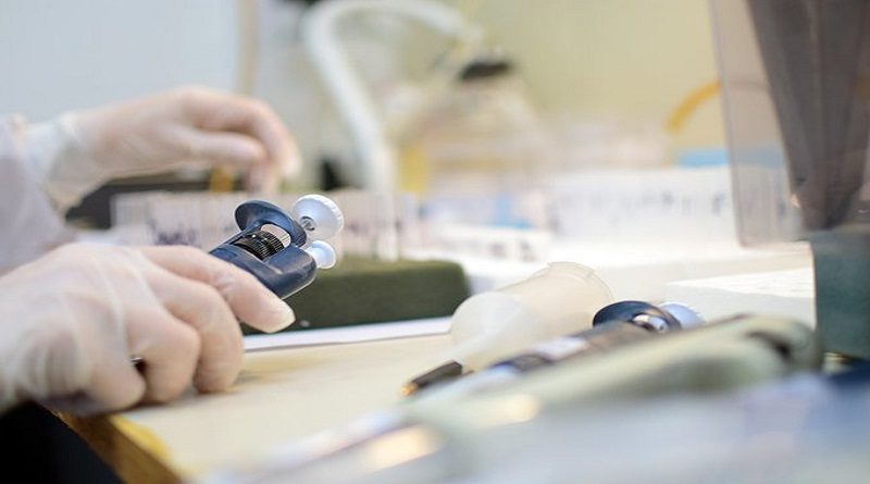 Investigadores venezolanos participan en proyecto científico que evalúa inmunidad contra el SARS-CoV-2