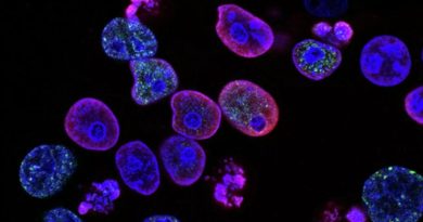 Este es el cáncer silencioso que ataca el cuerpo