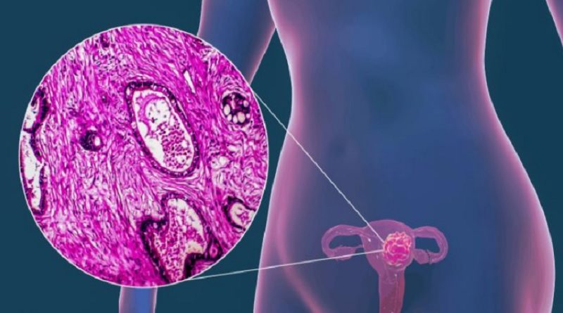 Una dosis de vacuna contra papiloma previene cáncer cérvico uterino