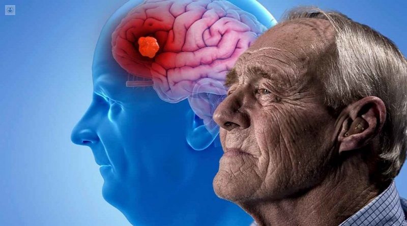 Fortalece la memoria y combate el Alzheimer con vitamina B12
