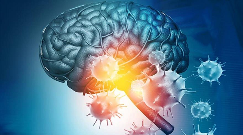 Estudio revela que la COVID-19 grave envejece 20 años el cerebro