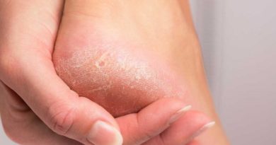 Resequedad en los pies podría estar asociada a problemas de salud
