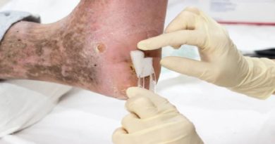 Pacientes con Pie Diabético reciben atención especializada en el territorio nacional