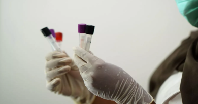 Microchip permitirá cultivar esperma en laboratorio