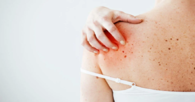 Desarrollan tratamiento que elimina células cancerígenas de la piel en un 100%