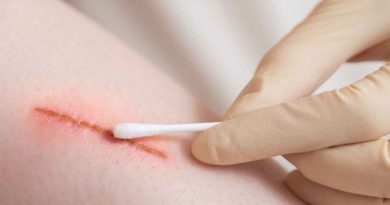 Descubre cuáles errores podemos cometer al curar una herida