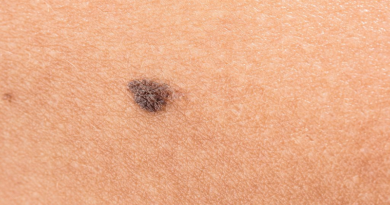 Conoce el software capaz de detectar el cáncer de piel