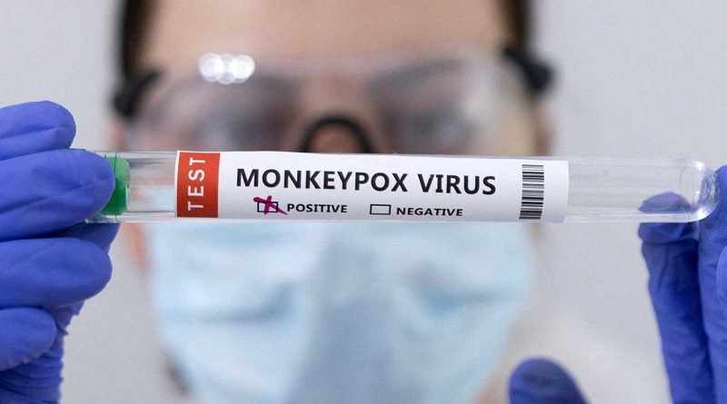 España confirma segunda muerte por viruela del mono