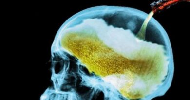 Sabías que consumir alcohol con frecuencia provoca deterioro cognitivo