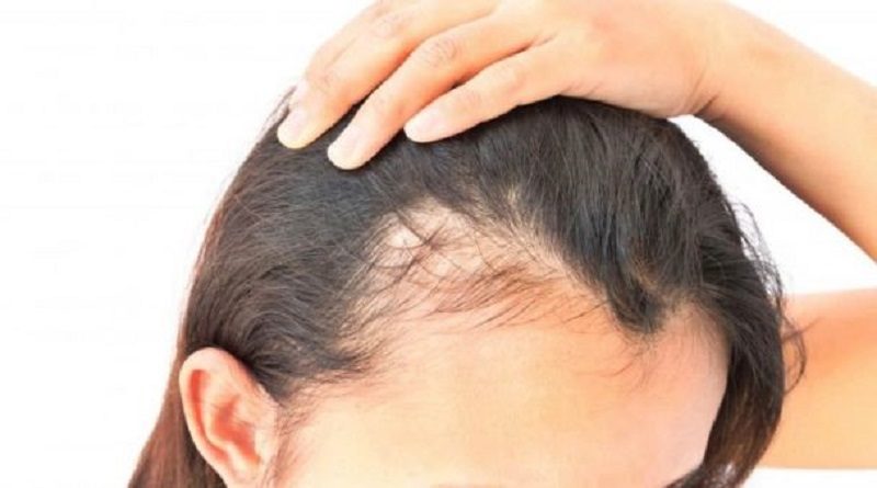 Descubren molécula que estimula el crecimiento del cabello nuevo
