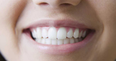 Estos son los alimentos que dañan la salud de los dientes