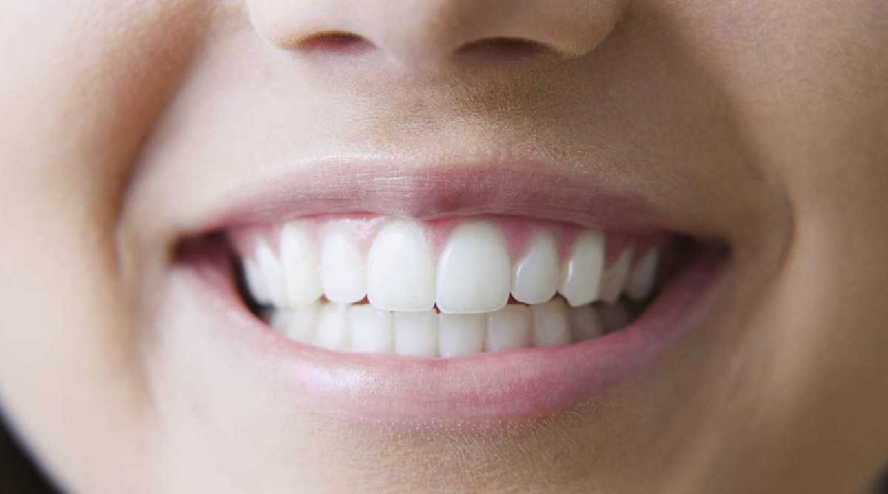 Estos son los alimentos que dañan la salud de los dientes