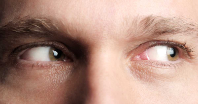 ¿Cómo afecta el dormir mal a la salud de los ojos?
