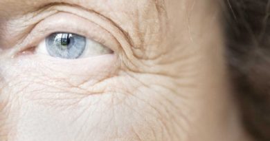 Conoce cómo eliminar las arrugas en los ojos