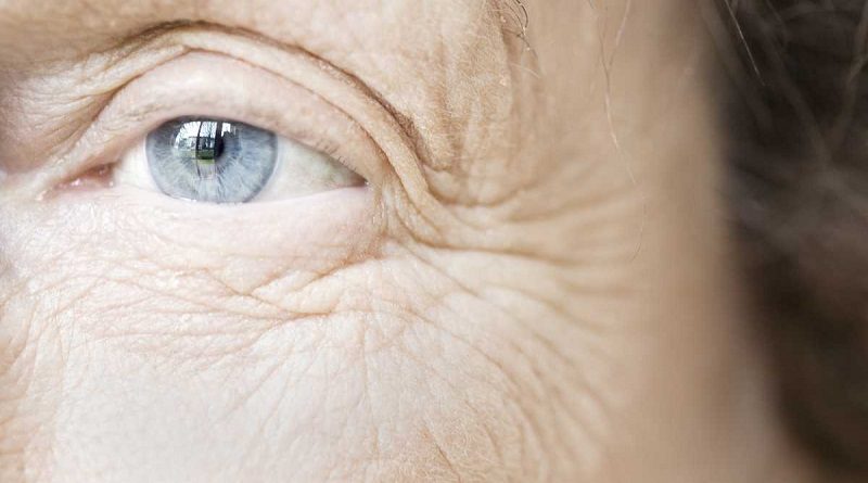 Conoce cómo eliminar las arrugas en los ojos