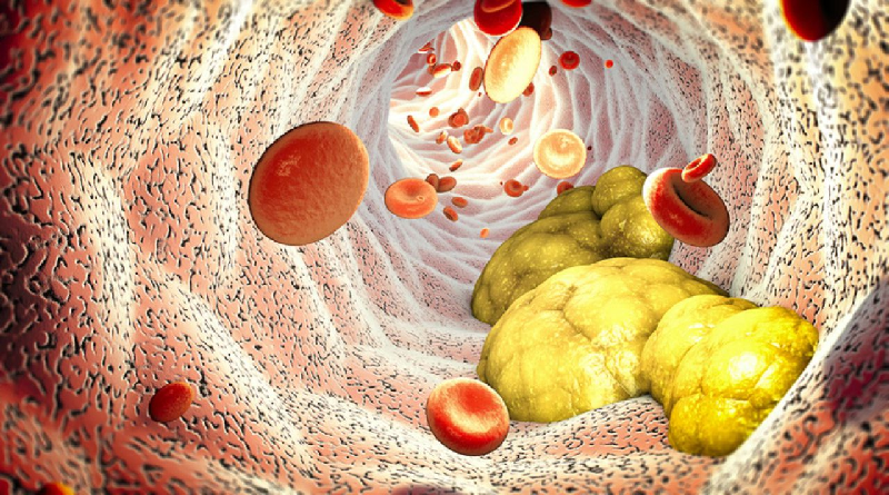 Colesterol alto: la planta medicinal que ayuda a reducirlo